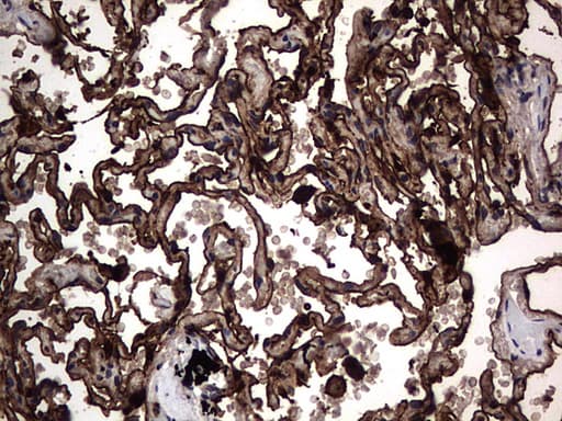 CEACAM5 / CD66e Antibody (aa35-680, clone OTI1C2)