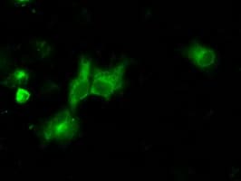 Monoclonal Mouse anti-Human NPR3 Antibody (clone OTI11B6, IHC, IF, WB)