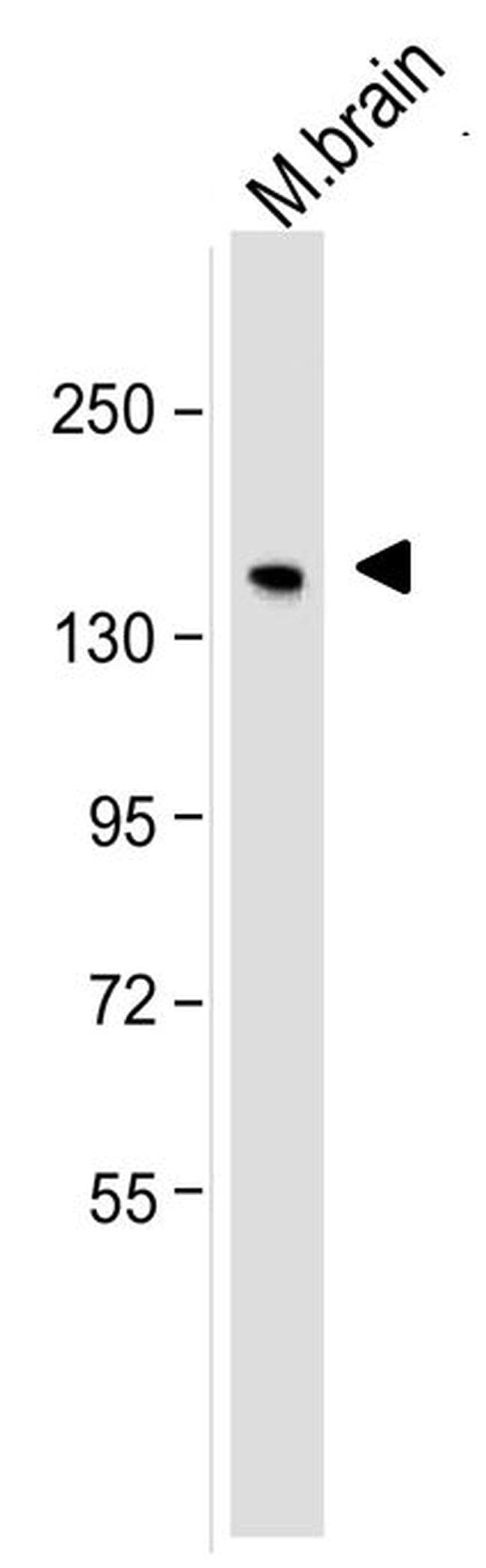 NEFM / NF-M Antibody (clone RMO 14.9)