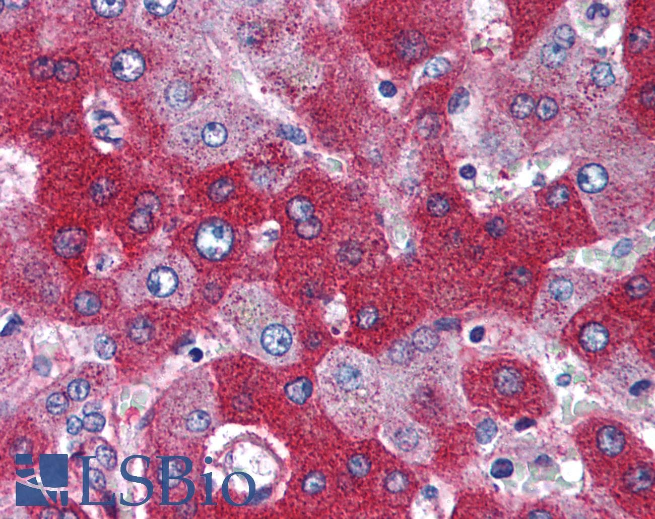 IHC-plus™ Polyclonal Rabbit anti-Human RNF216 / TRIAD3 Antibody (aa350-400, IHC, WB)