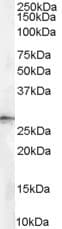 IHC-plus™ Polyclonal Goat anti-Human SFN / Stratifin / 14-3-3 Sigma Antibody (aa204-217, IHC, WB)