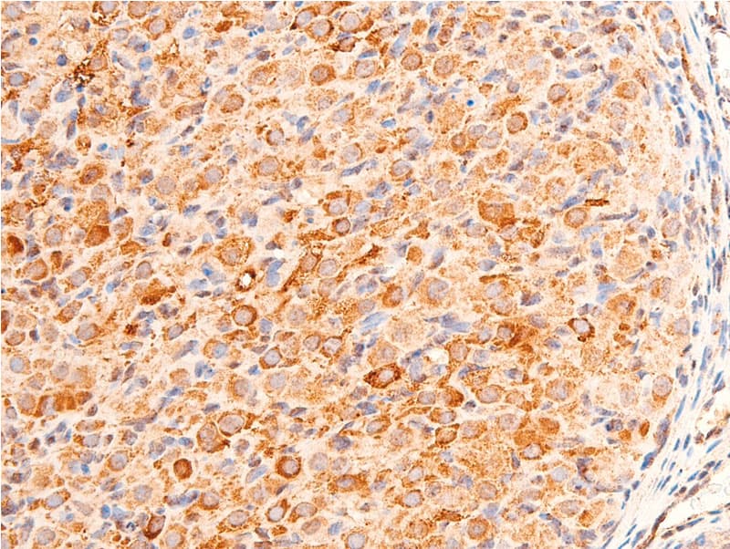 Polyclonal Rabbit anti-Human CHEK1 / CHK1 Antibody (phospho-Ser280, IHC, IF, WB)