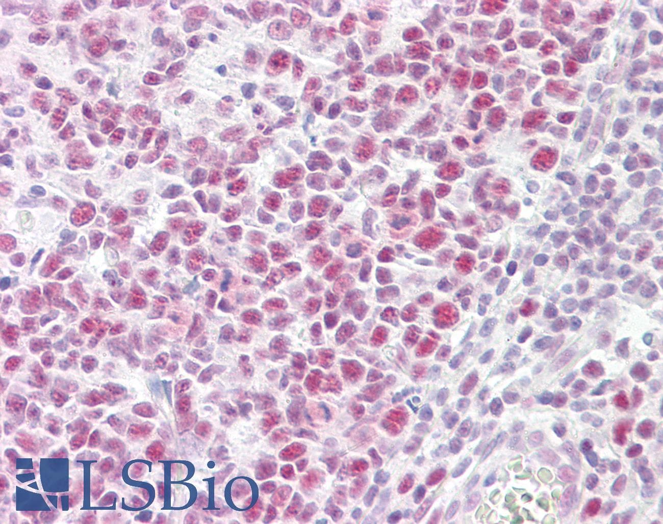 PathPlus™ EP300 / p300 Antibody (aa1-50)
