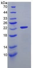 Mouse IL11 Protein (Recombinant His-T7)