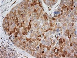 MAPRE2 / EB2 Antibody (clone OTI5F3)