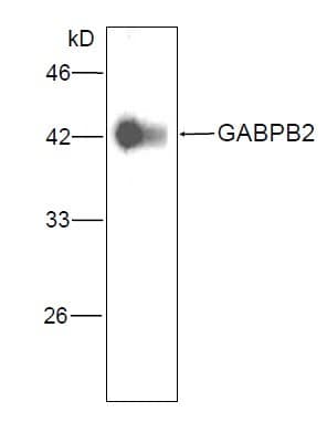 GABPB2 Antibody