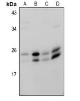 Polyclonal Rabbit anti-Human RAB18 Antibody (WB)