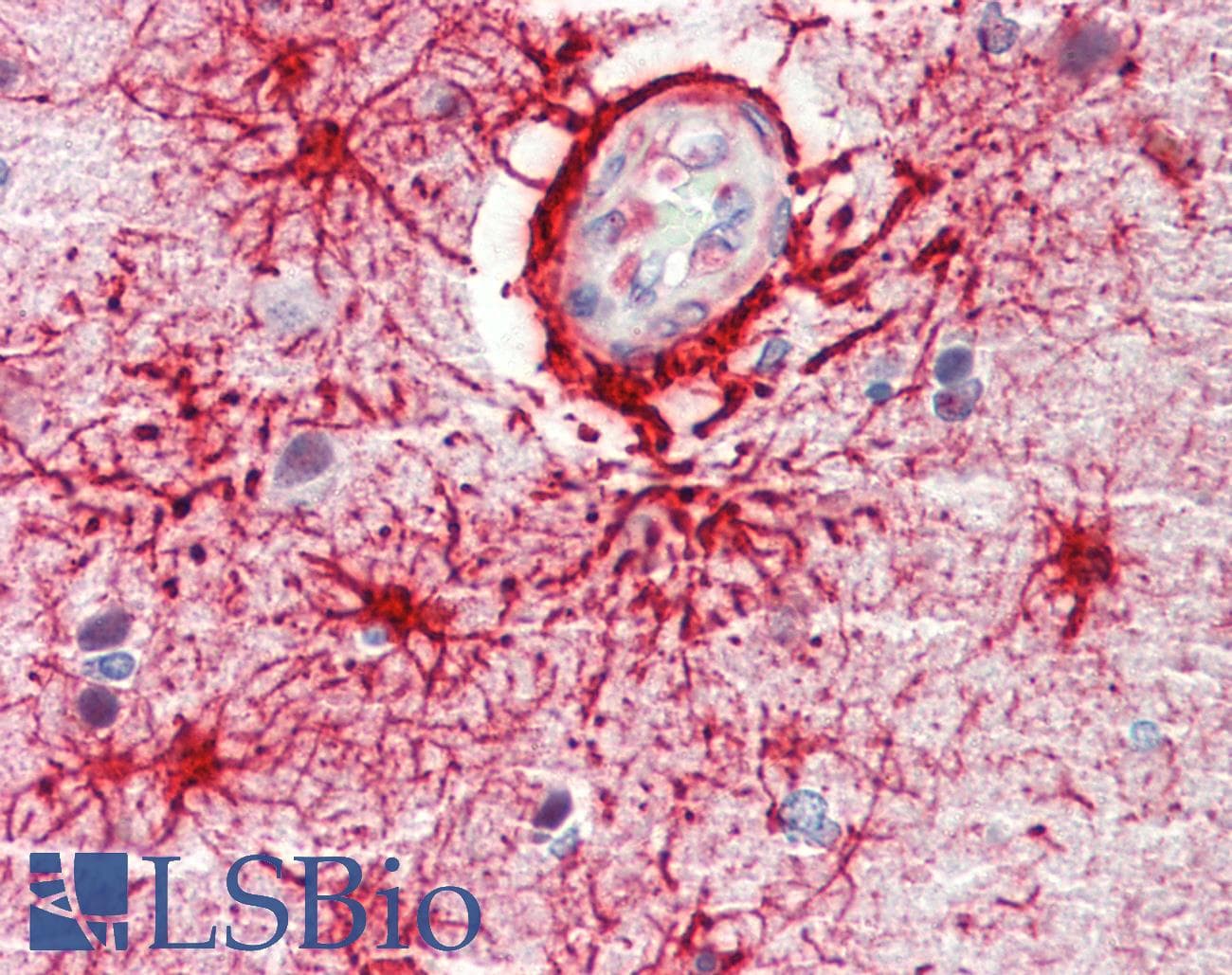 IHC-plus™ Polyclonal Rabbit anti-Human CSNK1G1 / CKI-Gamma 1 Antibody (aa1-50, IHC, WB)