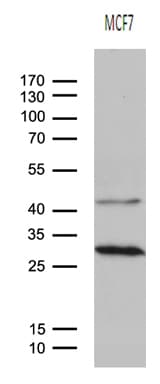 Monoclonal Mouse anti-Human OIP5 Antibody (clone OTI1F1, IHC, WB)