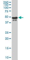 STK38 Antibody (clone 3A5)
