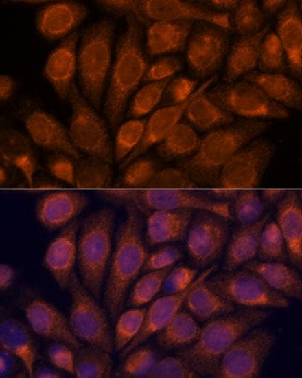 Polyclonal Rabbit anti-Human IPO4 Antibody (IF)