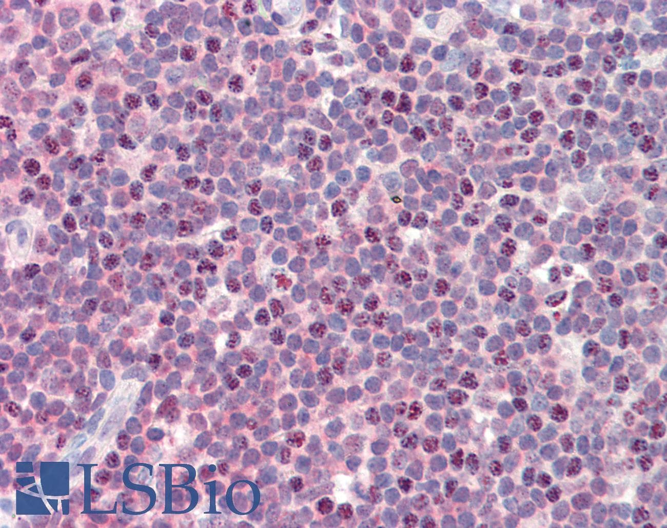 IHC-plus™ PSMB10 Antibody (aa231-242)