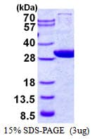 Human GCLM Protein (Recombinant His)