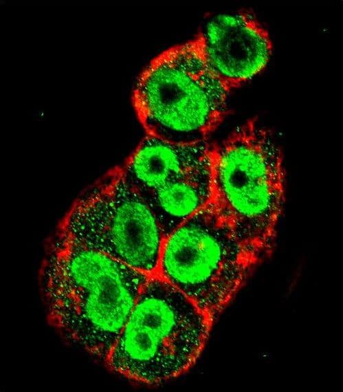 IHC-plus™ Polyclonal Rabbit anti-Human TIMP1 Antibody (aa157-188, IHC, IF, WB)
