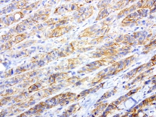 Monoclonal Mouse anti-Human L1CAM Antibody (clone UMAB48, IHC, IF, WB)