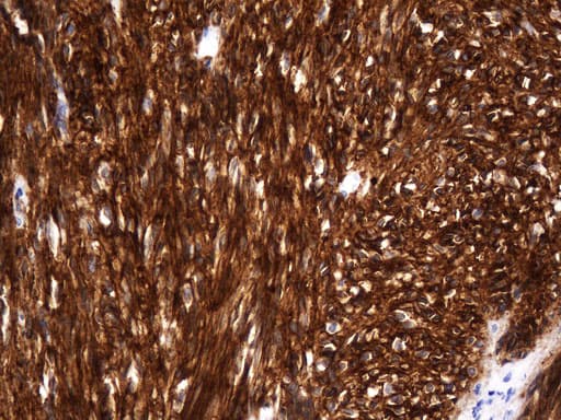 Monoclonal Mouse anti-Human ANO1 / DOG1 / TMEM16A Antibody (clone UMAB250, Carrier-free, aa1-333, IHC)