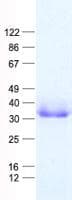 Human AEBP2 Protein (Recombinant His, N-Terminal)