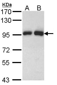 IHC-plus™ GSN / Gelsolin Antibody