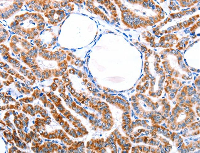 ER Alpha / Estrogen Receptor Antibody