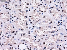 Monoclonal Mouse anti-Human PSMD10 / Gankyrin Antibody (clone OTI3F6, WB)