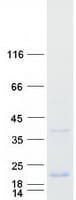 Human SMIM14 / C4orf34 Protein (Recombinant Myc-DDK (Flag))