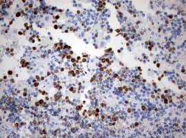 MKI67 / Ki67 Antibody (aa1160-1493, clone OTI5D5)