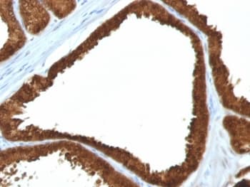 IDH1 / IDH Antibody (aa280-420, clone IDH1/1152)