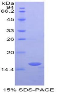 Mouse RBP3 / IRBP Protein (Recombinant His-T7)