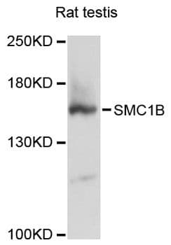 SMC1B Antibody