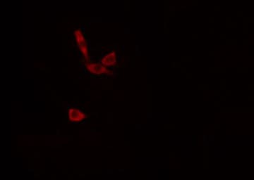 AGPAT9 / MAG1 Antibody