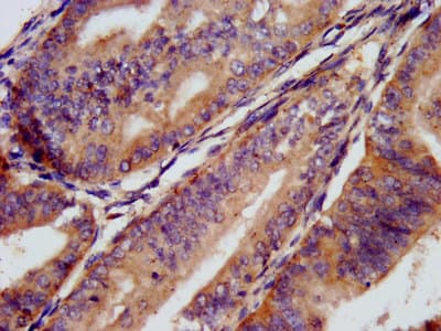 Polyclonal Rabbit anti-Human CD1E Antibody (IHC)