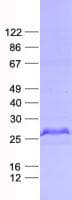 Human HAUS2 Protein (Recombinant His, N-Terminal)