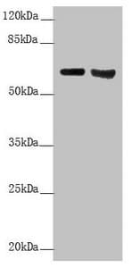 KRT6A / CK6A / Cytokeratin 6A Antibody