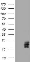 CGB / hCG Beta Antibody (clone OTI2A3)
