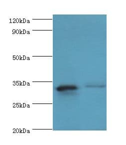 Polyclonal Rabbit anti-Human SLC25A15 / ORNT1 Antibody (aa1-301, IHC, WB)