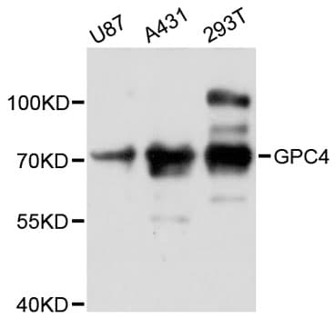 Polyclonal Rabbit anti-Human GPC4 / Glypican 4 Antibody (IHC, WB)