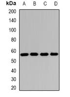 OXCT1 Antibody