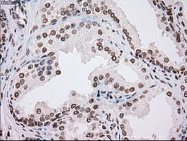 TYRO3 Antibody (clone OTI5B4)