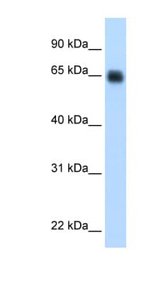 PathPlus™ KNG1 / Kininogen / Bradykinin Antibody (aa251-300)