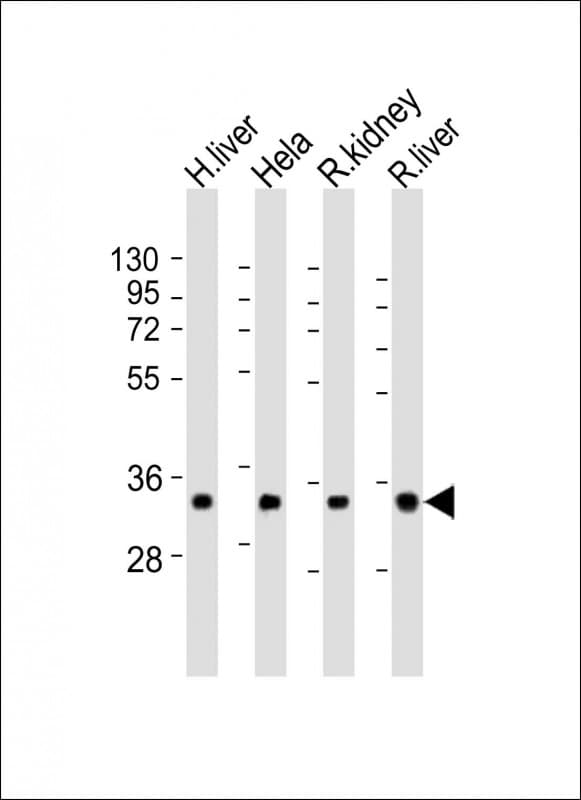 Polyclonal Rabbit anti-Human Rhodanese / TST Antibody (aa170-203, IHC, WB)