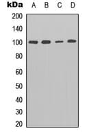 ENPP3 / CD203c Antibody (Internal)
