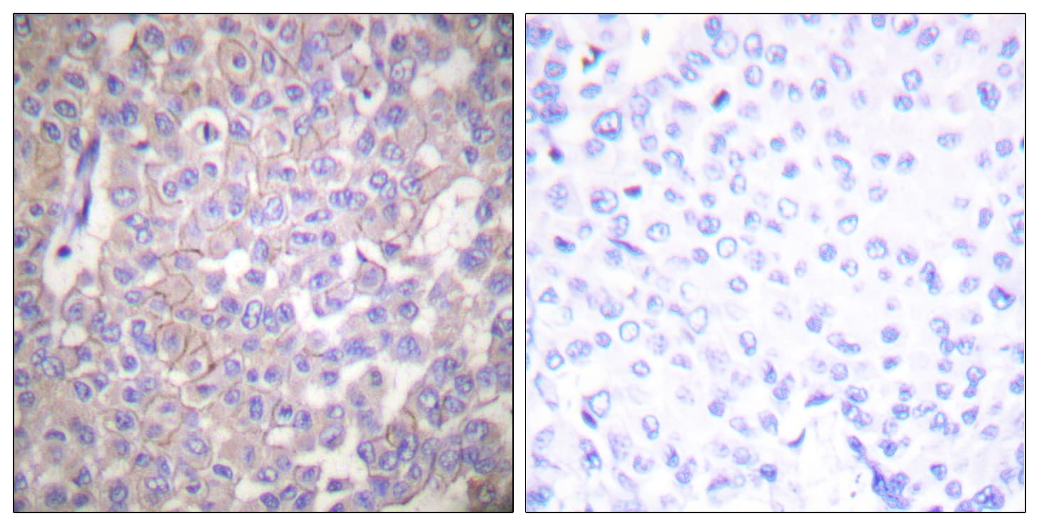 Polyclonal Rabbit anti-Human CLDN2 / Claudin 2 Antibody (aa181-230, IHC, WB)