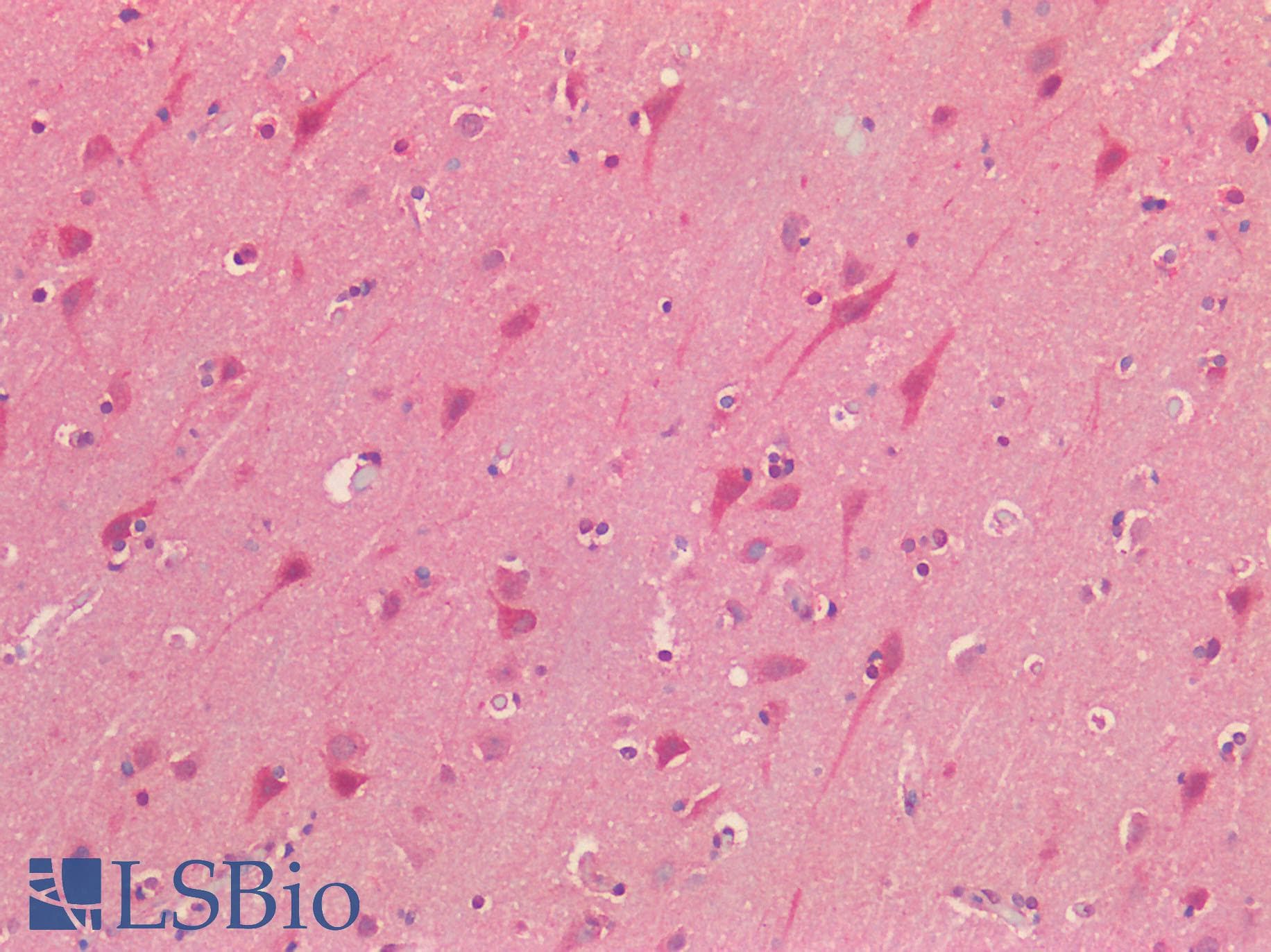 IHC-plus™ NALP3 / NLRP3 Antibody (N-Terminal)