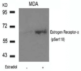 ER Alpha / Estrogen Receptor Antibody