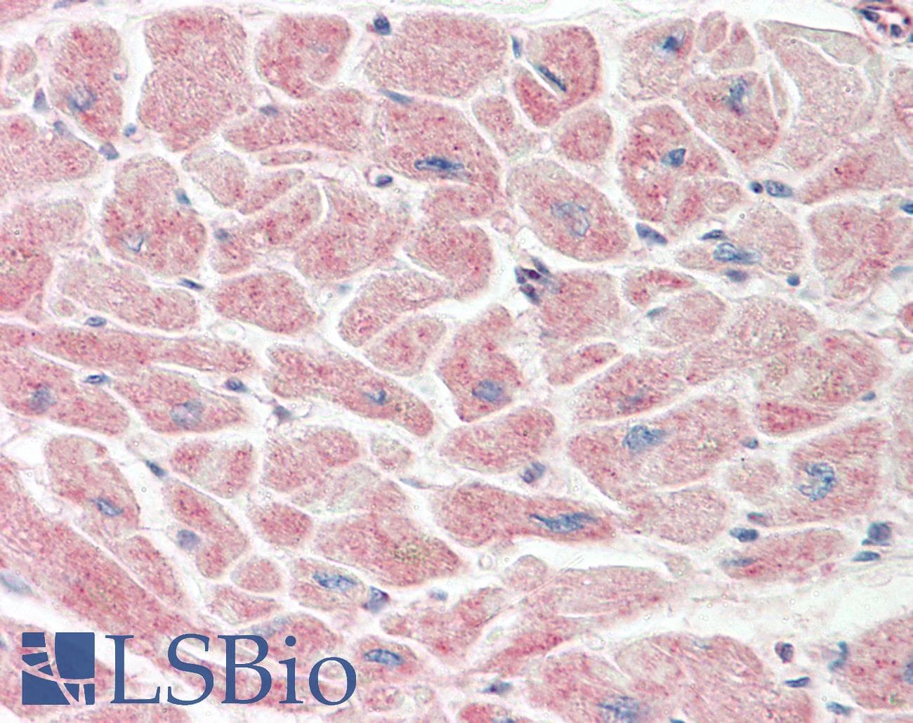 TADA3 / ADA3 Antibody (C-Terminus)