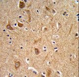 ITGA6/Integrin Alpha 6/CD49f Antibody (aa1082-1110)