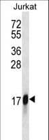 Polyclonal Rabbit anti-Human HMGN2 Antibody (aa1-30, WB)