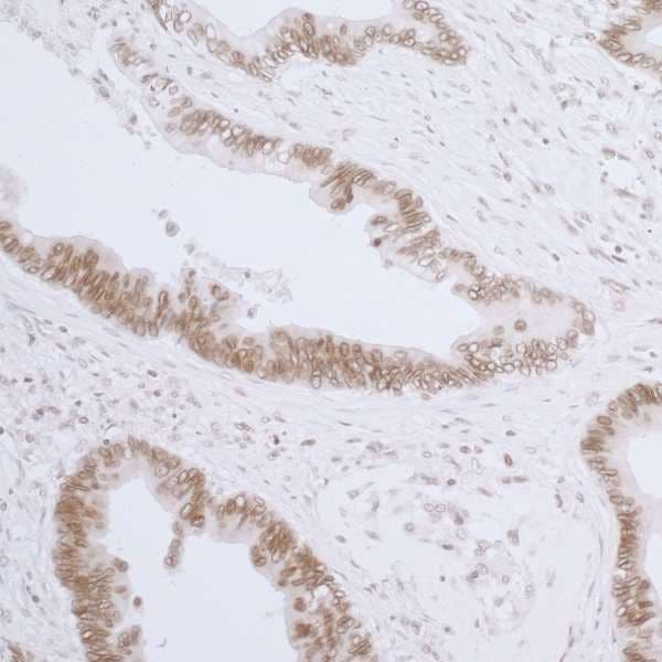 TMPO / TP / Thymopoietin Antibody (aa225-275)