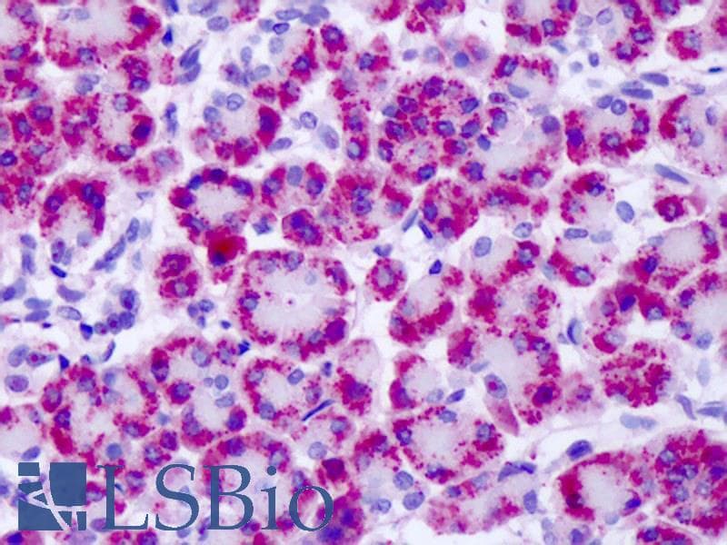 IHC-plus™ Polyclonal Rabbit anti-Human GRM4 / MGLUR4 Antibody (C-Terminus, IHC)