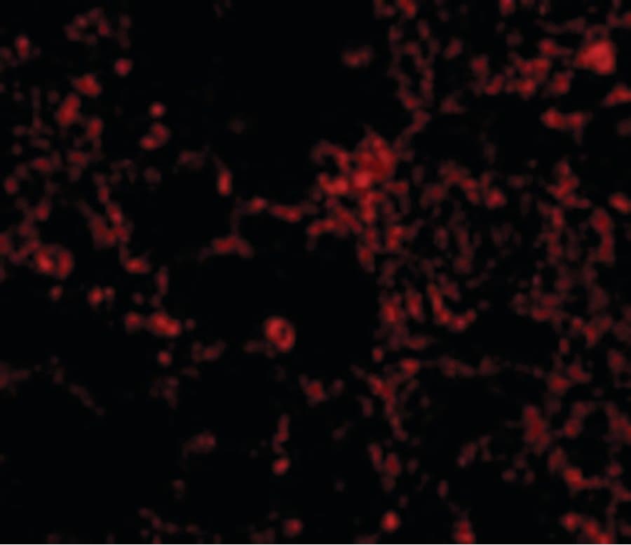 IHC-plus™ IL21 Receptor Antibody